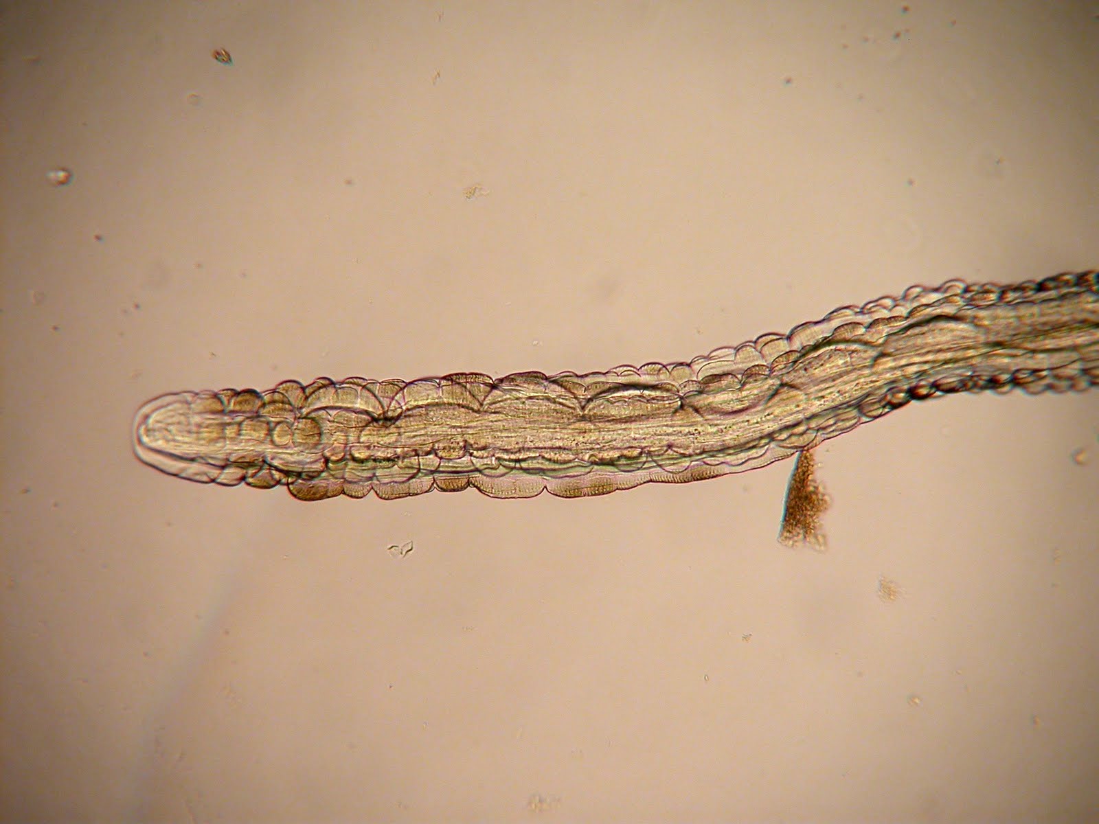Parasite of the Day: July 2010